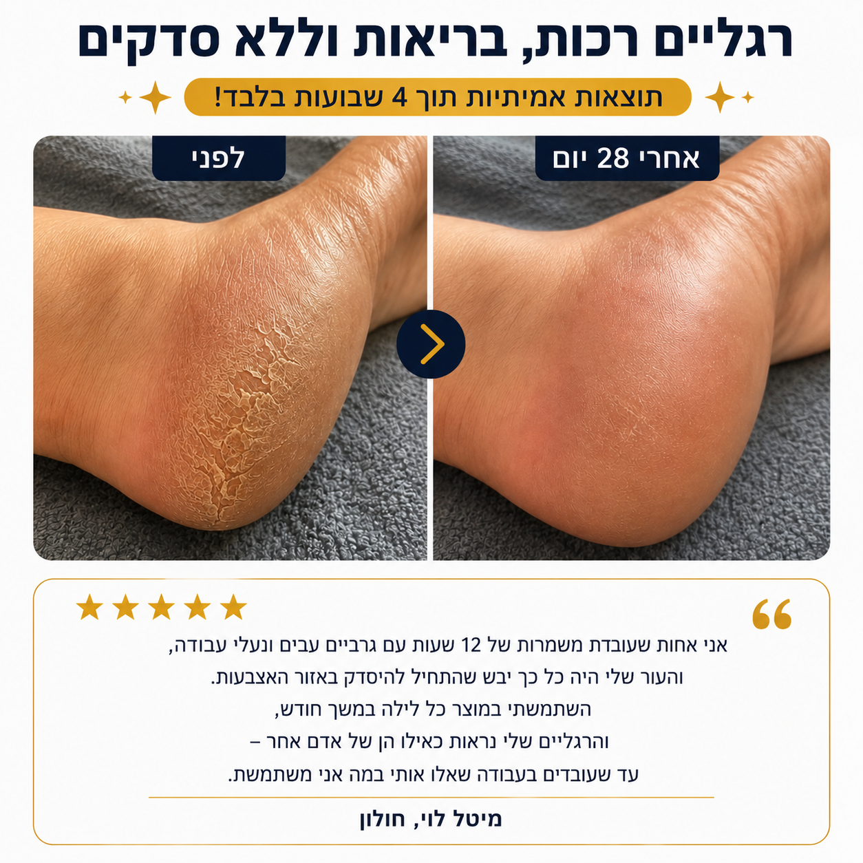 סטיק האוריאה – חיסול יובש העקבים ב-30 יום, בלי לצאת מהבית