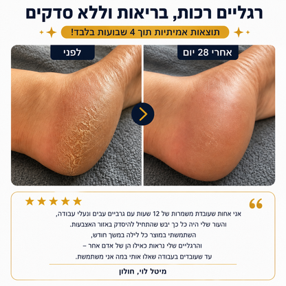 סטיק האוריאה – חיסול יובש העקבים ב-30 יום, בלי לצאת מהבית
