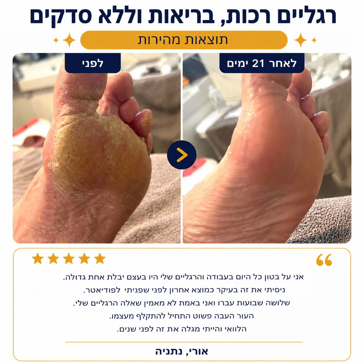 סטיק האוריאה – חיסול יובש העקבים ב-30 יום, בלי לצאת מהבית