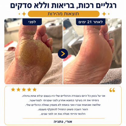 סטיק האוריאה – חיסול יובש העקבים ב-30 יום, בלי לצאת מהבית
