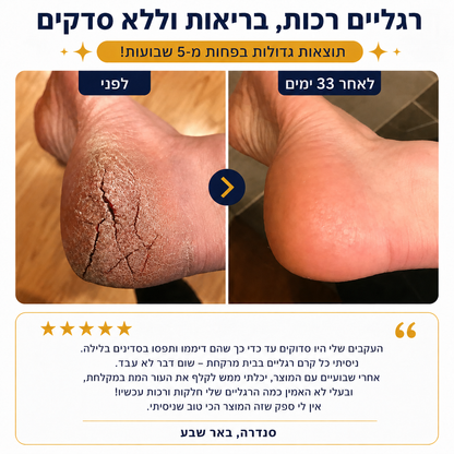 סטיק האוריאה – חיסול יובש העקבים ב-30 יום, בלי לצאת מהבית